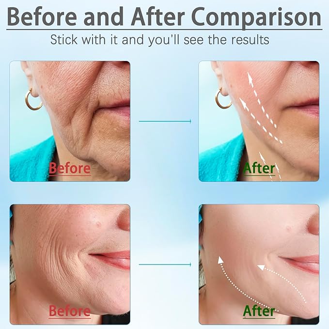 Moderno Masajeador Lifting Facial