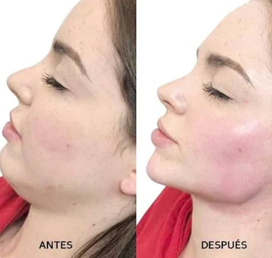 Moderno Masajeador Lifting Facial